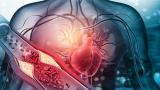 Bí quyết ăn uống giúp giảm cholesterol hiệu quả nhất